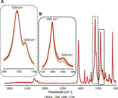 Unveiling the Enzymatic Degradation Process of Biobased Thiophene Polyesters